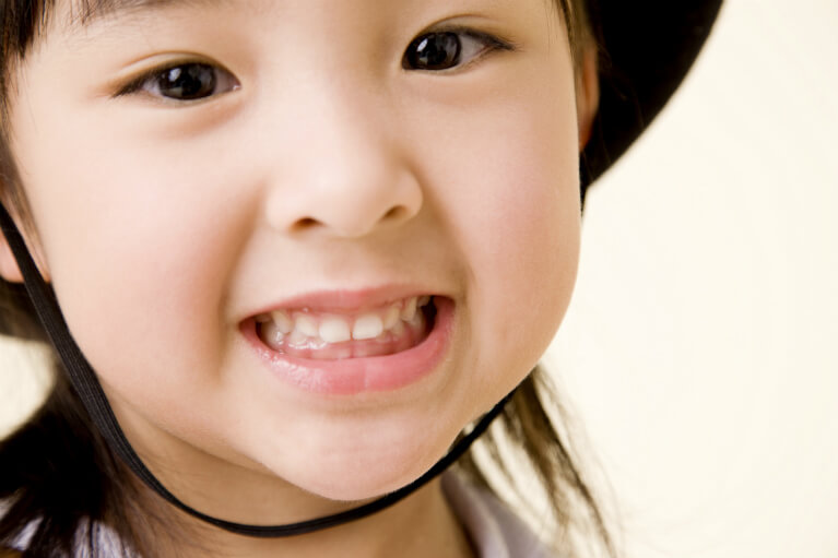 お子さんのための予防歯科 お子さんのための予防歯科
